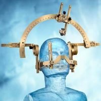 Stereotactic frame positioned on a mannequin head, used for precise neurosurgical procedures.