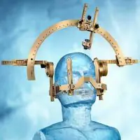 Stereotactic frame positioned on a mannequin head, used for precise neurosurgical procedures.
