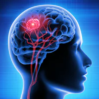 Illustration of a human brain with a highlighted tumor and red blood vessels, set against a blue background.