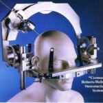 Mannequin head fitted with the Cosman-Roberts-Wells stereotactic system, a metal frame used for precise brain surgery.