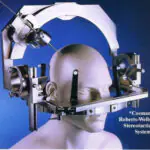 Mannequin head fitted with the Cosman-Roberts-Wells stereotactic system, a metal frame used for precise brain surgery.