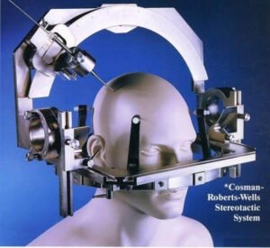 Mannequin head fitted with the Cosman-Roberts-Wells stereotactic system, a metal frame used for precise brain surgery.
