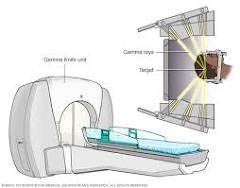 Illustration of a Gamma Knife unit with a patient positioned on the treatment table and an inset showing the delivery of gamma rays targeting a specific area in the brain.