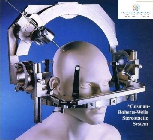 Image of a mannequin head fitted with the Cosman-Roberts-Wells stereotactic system, a complex metal framework used for precise brain surgery
