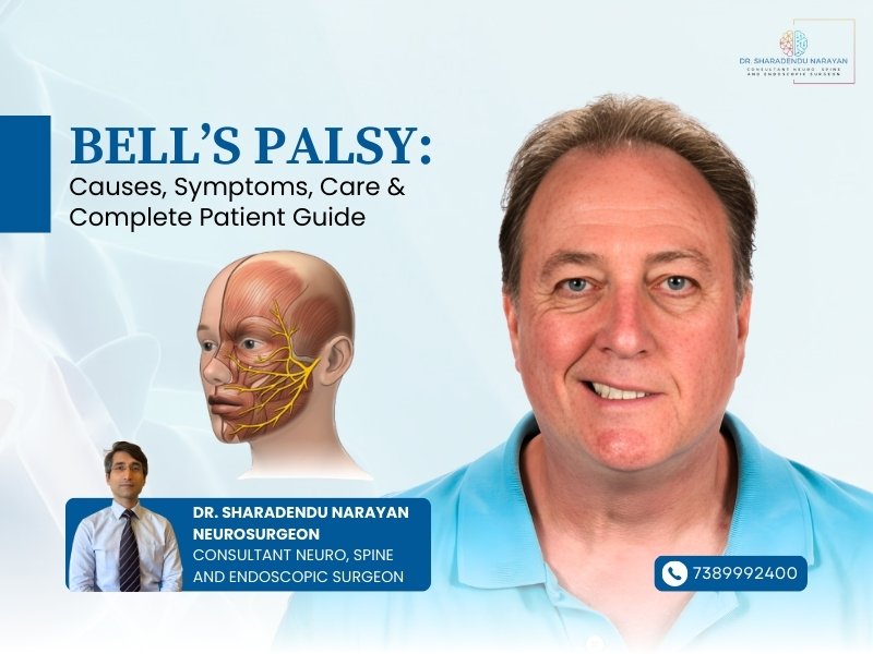 Best Doctors for Bell S Palsy Treatment in Jamshedpur explaining causes, symptoms, and complete care guide for facial paralysis