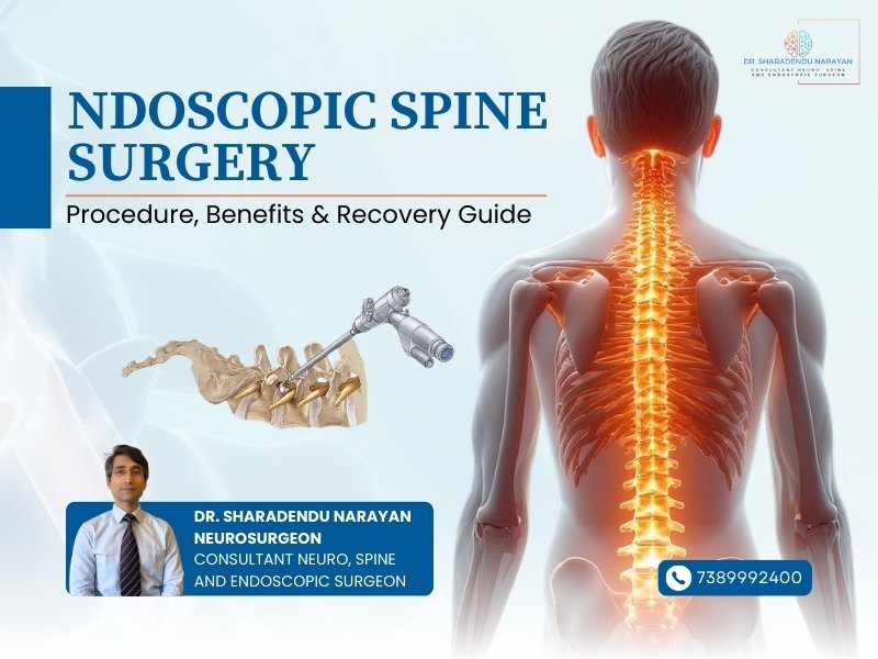 Endoscopic Spine Surgery in Jamshedpur showing minimally invasive spine surgery procedure for slip disc and sciatica treatment